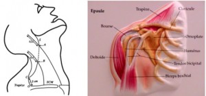 Paralysie Du Trapeze Par Lesion Du Nerf Spinal Xi 18093348