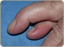 Finger1